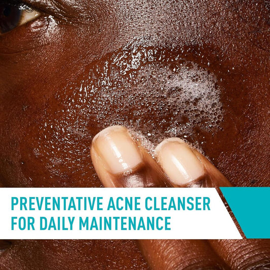 Cerave Acne Control Cleanser